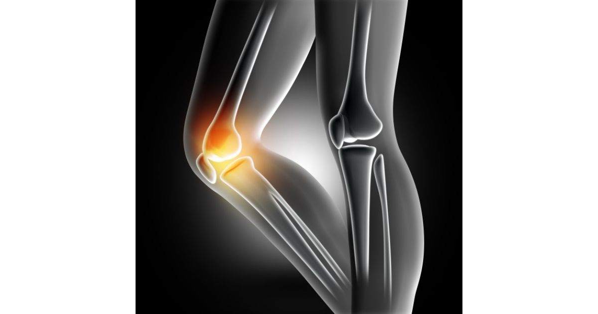 joint-pain