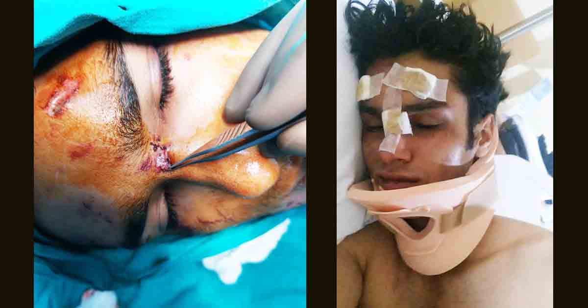 Restaurant bouncers attack teenager 3
