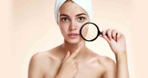 bigstock-Teen-girl-with-problem-skin-lo-83429171