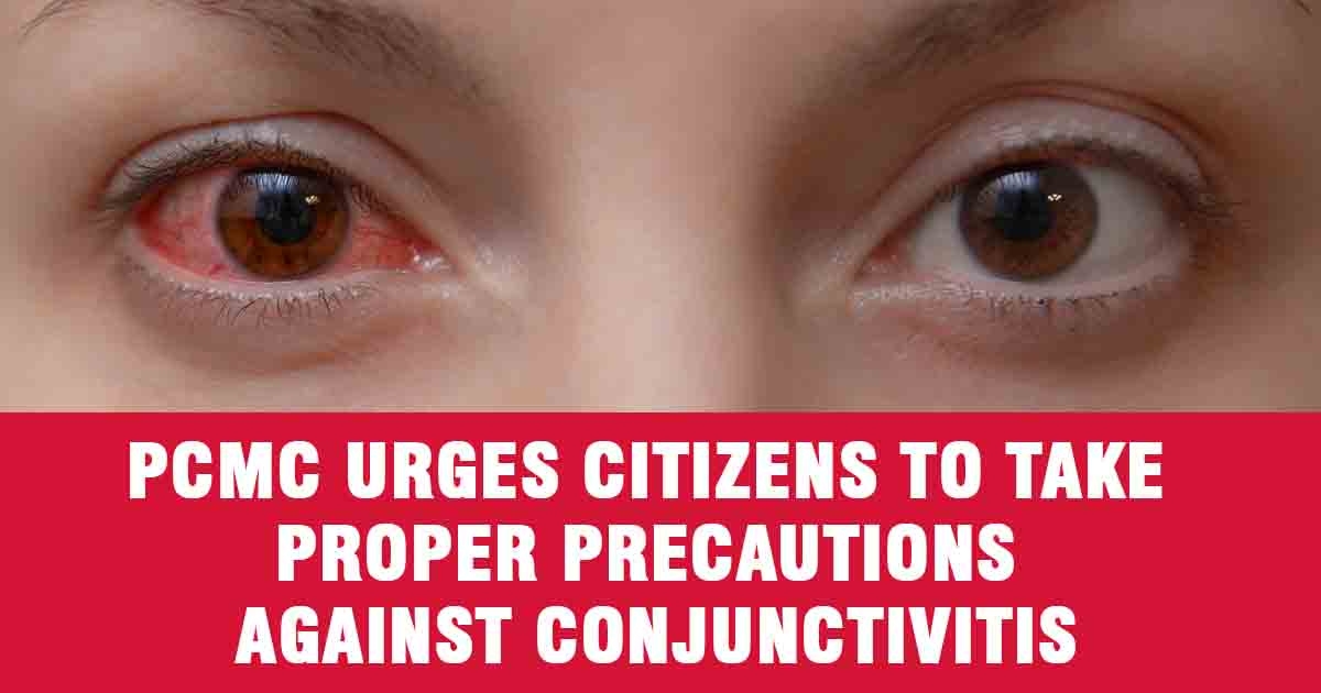 PCMC Urges Citizens to Take Proper Precautions Against Conjunctivitis