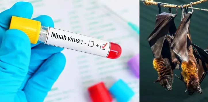 Nipah virus