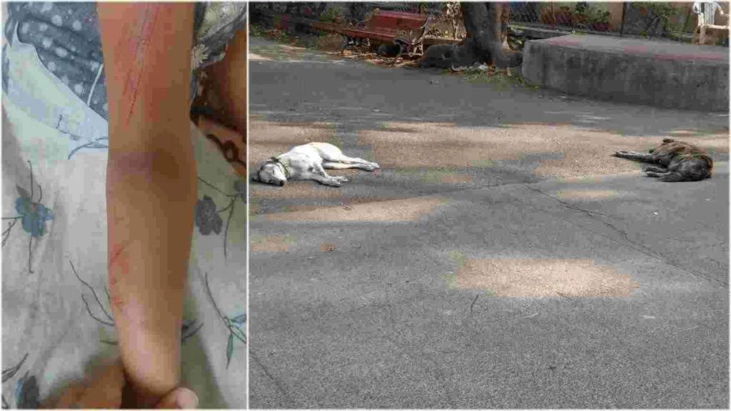 Pune : Stray dog allegedly attacks 7 year old girl in Bibvewadi, residents seek PMC's attention