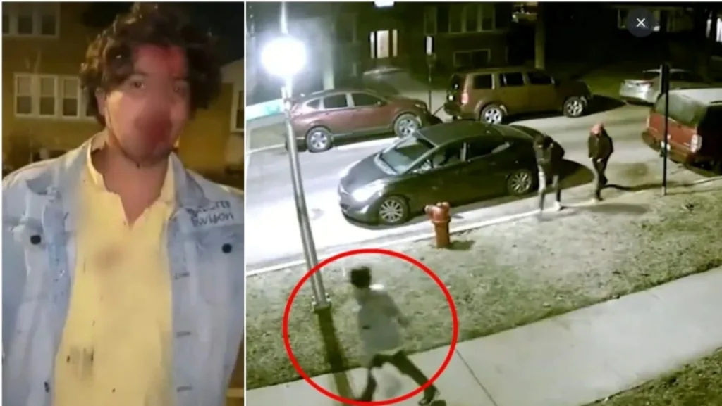 Watch: Indian student bleeds profusely in video after attack in US