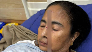 West Bengal CM Mamata Banerjee Suffers Major Injury in Accident, Taken to Hospital