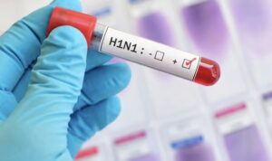 Swine Flu Claims Life of Woman in Nashik, Two Others Under Treatment