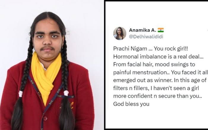UP Board Class 10 Topper Prachi Nigam trolled online for facial hairs