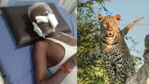 Pune : 65-Year-Old Farmer Attacked by Leopard, Seriously Injured in Bharadi Settlement