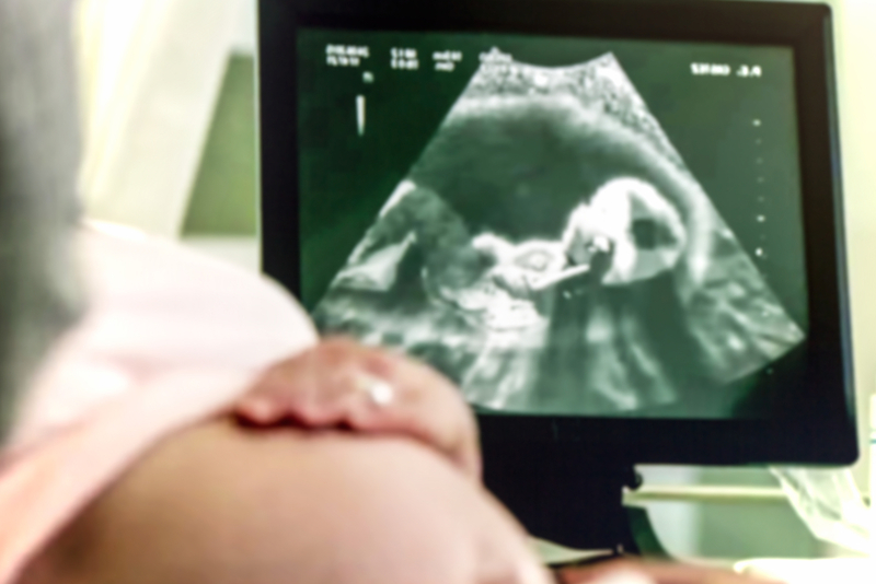 Pune: PMC launches drive to prevent misuse of sonography machines for determining sex of the foetus