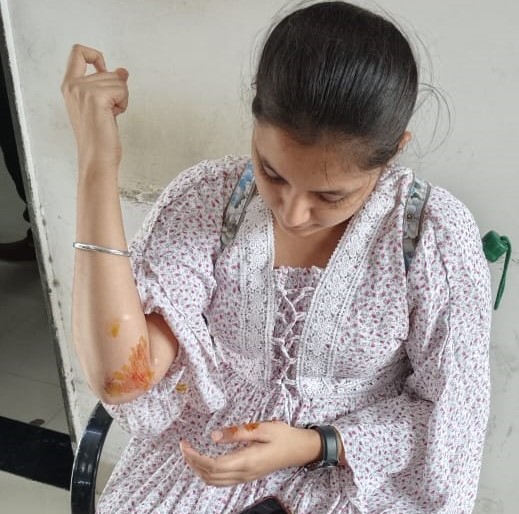 Pune: RPF Chinchwad staff helps passenger fallen from local, medical first aid offered under operation Jeevan Raksha