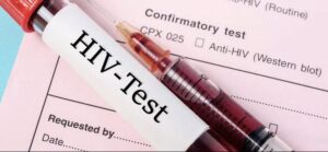 47 Students Die from HIV Infection, 828 Test Positive, Check the State and the Reason for the Sudden Surge