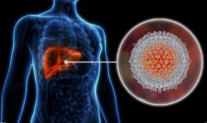 World Hepatitis Day: Battling The Monsoon Surge In Hepatitis Infections