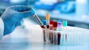 Maharashtra: Law To Monitor Pathology Labs Soon, Announces Uday Samant 