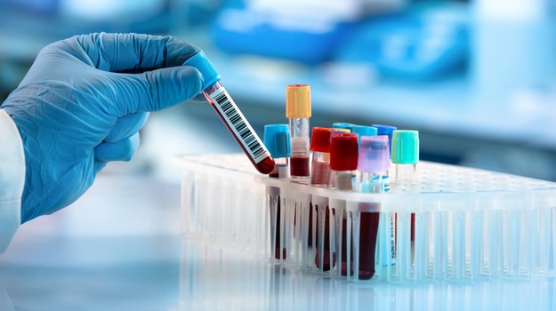 Maharashtra: Law To Monitor Pathology Labs Soon, Announces Uday Samant 