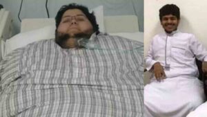 Journey from Fat to Fit How Saudi’s Khalid Shaari lost weight from 610 kg to 63 kg