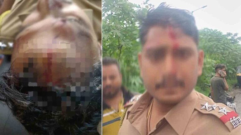 Koyata Attack On Police In Pune: Wanowrie Police Officer Injured