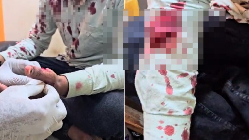 Pune Witnesses Alarming Rise In Crime Rate: Medical Shopkeeper Stabbed In Phursungi