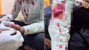 Pune Witnesses Alarming Rise In Crime Rate: Medical Shopkeeper Stabbed In Phursungi