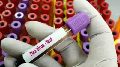 Five Deaths Reported as Zika Virus Cases Reach 100 in Pune, Pregnant Women Among the Infected