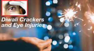 Pune News: Diwali Firecrackers Cause Eye Injuries: Ophthalmologists Sound Caution