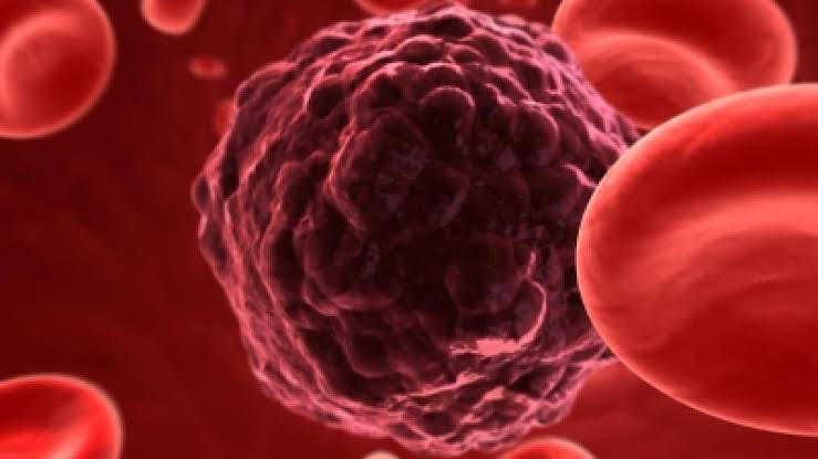 Early Detection Key to Beating Cancer Experts Warn on National Cancer Awareness Day