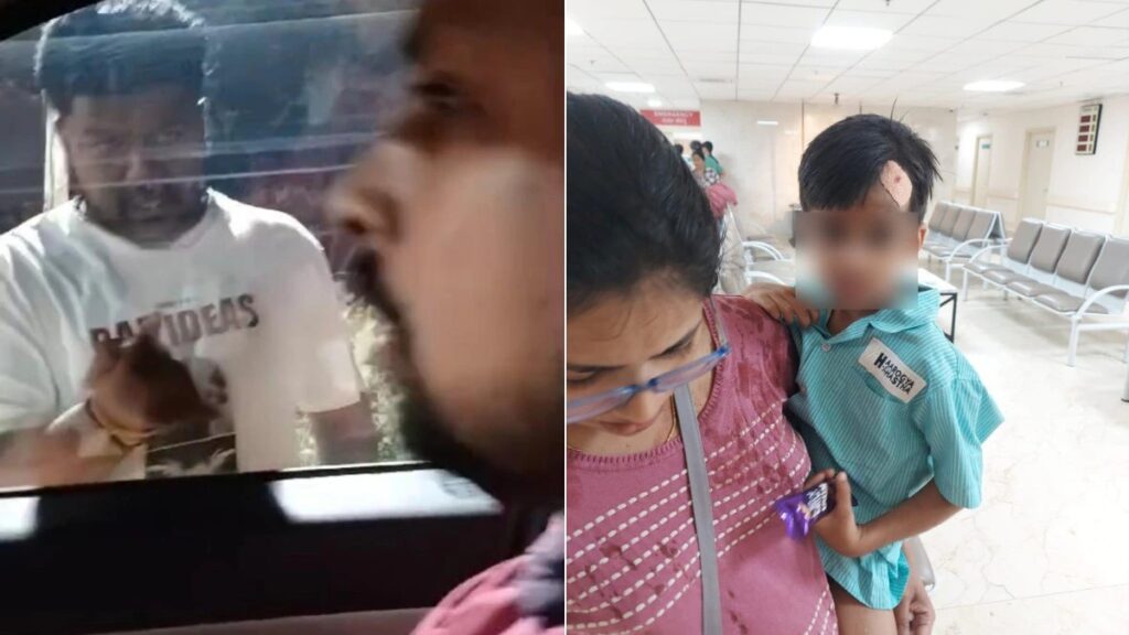 Captured on Camera, Bengaluru Road Rage: Child Injured as Family Faces Frightening Attack