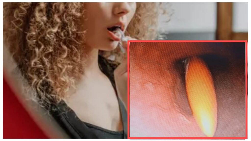 Rare Case in Pune: Woman Swallows 20-Cm Toothbrush While Cleaning Her Tongue