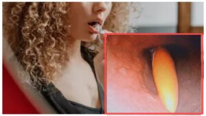 Rare Case in Pune: Woman Swallows 20-Cm Toothbrush While Cleaning Her Tongue