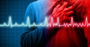 Prevention Better Than Cure: Rise of Cardiac Arrests Among Young Individuals