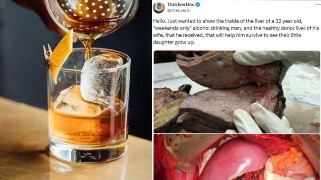 Indian Doctor Compares