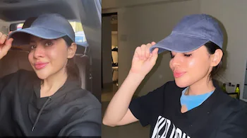 Uorfi Javed Reveals Dramatic Transformation Dissolves 8-Year-Old Chin Fillers