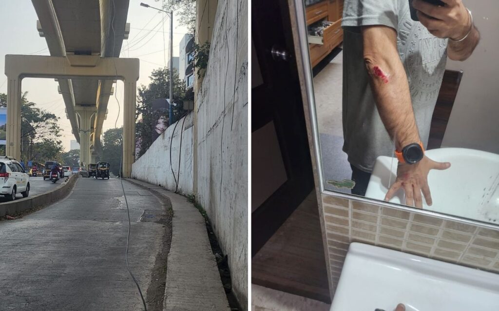 Pune: Kalyani Nagar Cyclist Injured By Dangling Wire At Nagar Road Underpass 