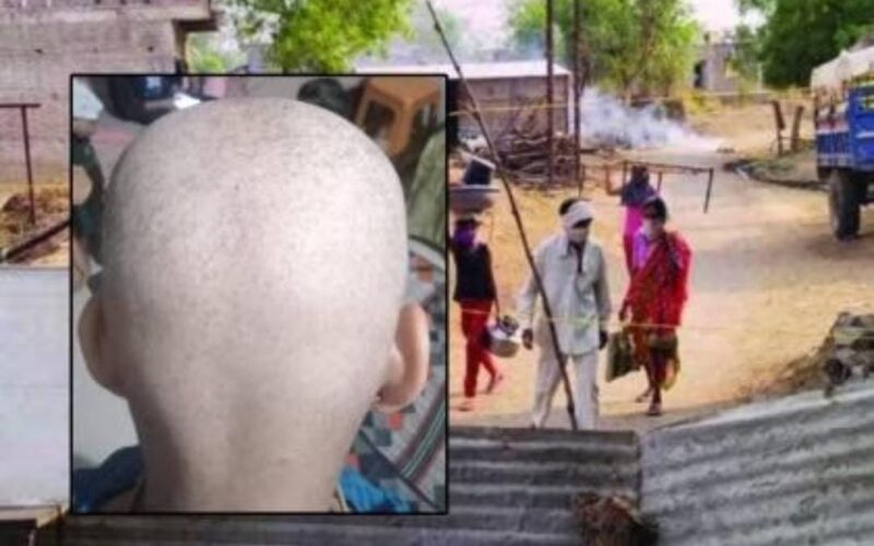 Mysterious Hair Loss Outbreak Sparks Fear In Buldhana