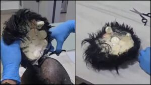 Colombian Man's Unique Trick to Smuggle Drugs Exposed – Watch Video!