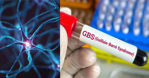 Pune: GBS Patients To Receive Government Aid For Treatment Expenses