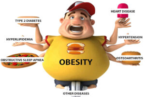 effects-of-obesity