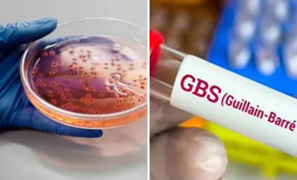 Pune GBS Outbreak: Not Just Water—New Study Points to Poultry as Possible Trigger