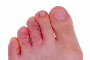 What Your Feet Are Trying to Tell You 5 Silent Symptoms of Underlying Health Issues