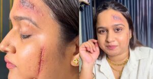 Pune Makeup Artist Pritam Juzar Kothawala Sparks Controversy with Viral Fake Scar Video