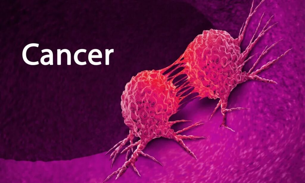 Experts Warn of Rising Anal Cancer Cases: Know These 10 Critical Symptoms`