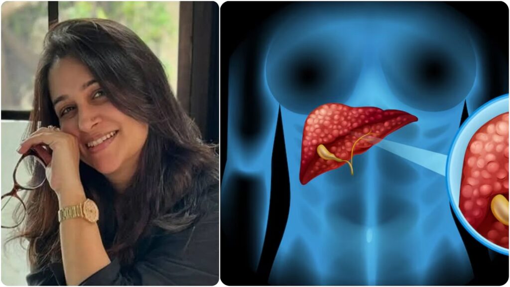Actor Dipika Kakar Diagnosed with Stage 2 Liver Cancer: Experts emphasize Don’t Ignore these Warning Signs