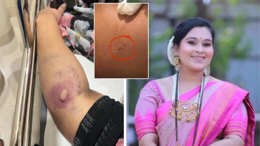 Pune News Postmortem Report Reveals Shocking Details In Vaishnavi Hagawane Death Case; Blunt Injuries, Neck Trauma Indicated