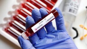 Covid-19 Cases Spike in Maharashtra: 53 Infections Reported in One Week
