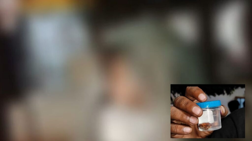 Man Bites Off Wife’s Nose After Catching Her with Lover in Uttar Pradesh, Detained by Police