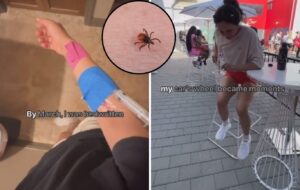 Fitness Icon Paralyzed by Tick-Borne Disease: Hidden Health Crisis underscores the Need for Awareness While Going Outdoors.