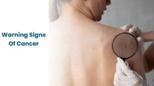 10 Early Cancer Warning Signs You Shouldn’t Ignore