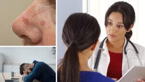 Attention Young Adults: Cancer Is Now Targeting You Faster Than Ever — Don’t Ignore These Early Red Flags