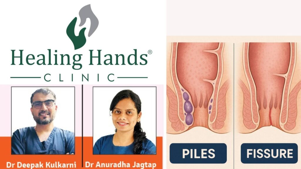 Ways to distinguish between piles and fissure