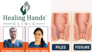 Ways to distinguish between piles and fissure