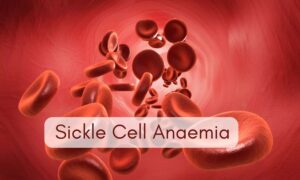 Affordable Sickle Cell Anaemia Test Kit To Launch Soon, Priced Under ₹100: CSIR Chief 