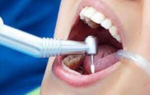 What is the Root Canal and Heart Health Connection? What You Should Know